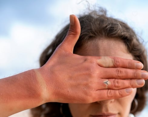 Adoptar medidas preventivas permite disfrutar de las vacaciones con seguridad y reduce riesgos de complicaciones asociadas a la exposición solar y al calor. - (Freepik)