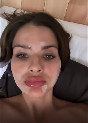 La quemadura con una bolsa