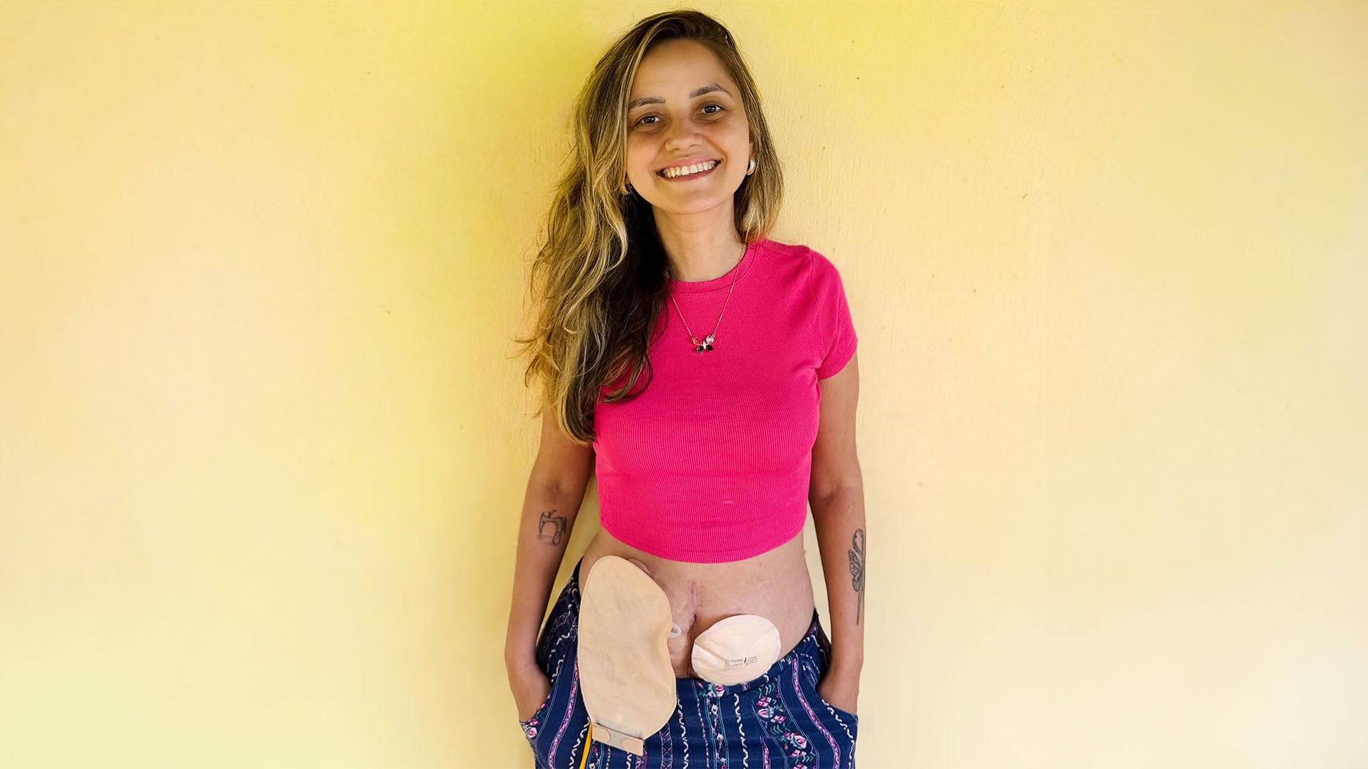 Miles de seguidores destacaron la valentía y fortaleza de Jessica Daugirdas, cuyo testimonio visibilizó el cáncer colorrectal en redes sociales (@jessicadaugirdas)