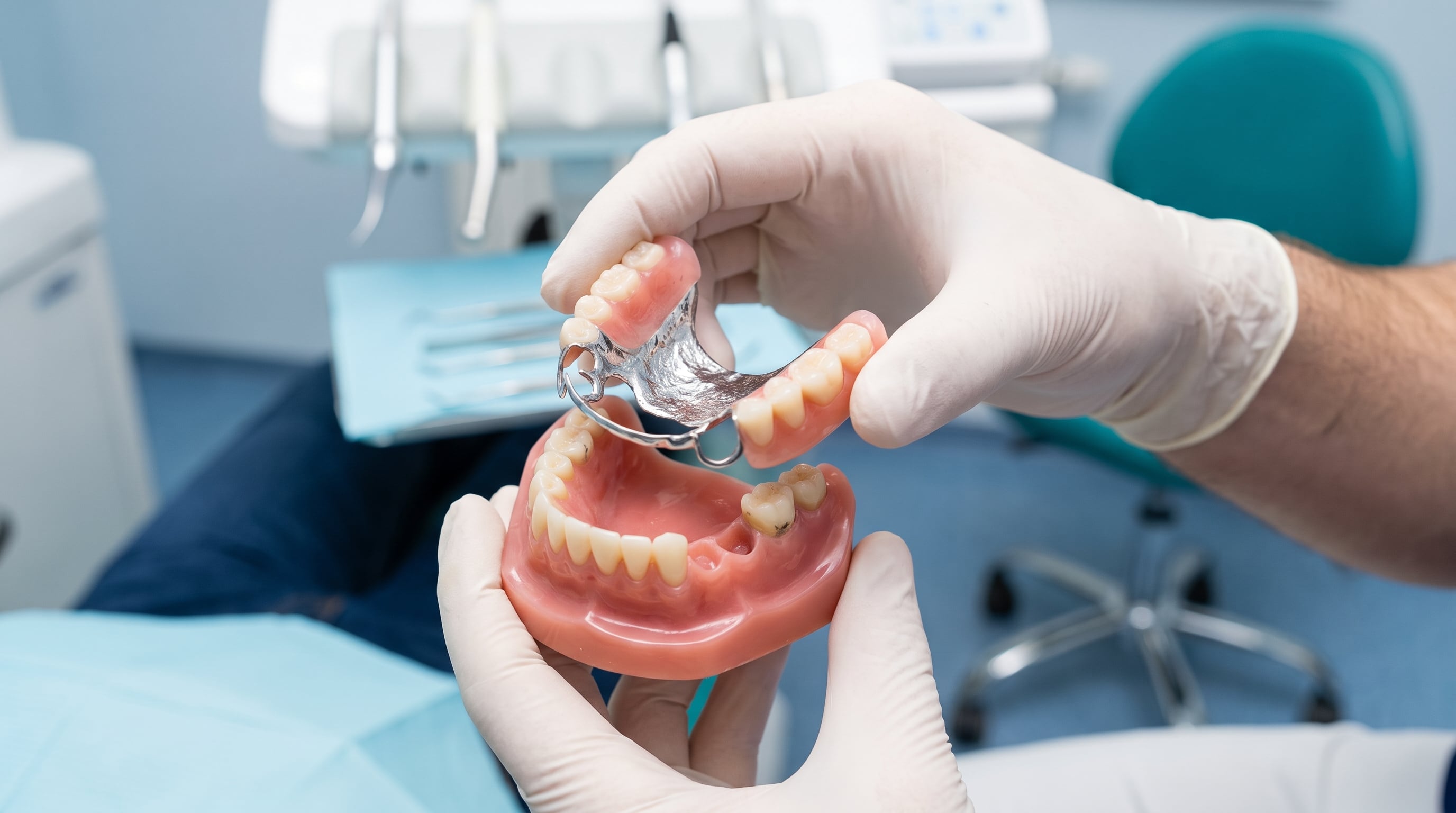 Ventajas de las prótesis dentales removibles frente a las fijas