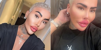 James Parke gastó miles de