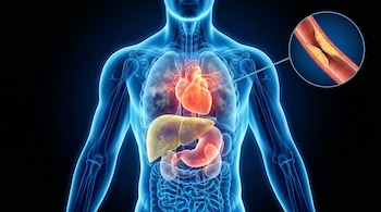 Ilustración 3D de un cuerpo humano translúcido azul que muestra órganos internos como corazón, hígado, estómago y pulmones, con un detalle de arteria bloqueada.