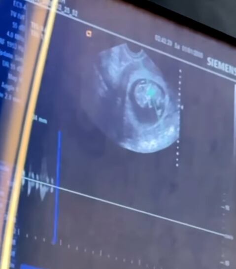 (IG: @marthahigareda)