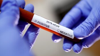Coronavirus en Argentina: presentan un