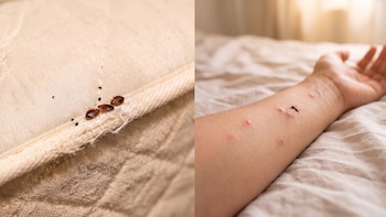 ¿Peligro en tu cama? Cómo saber si es un piquete de chinche o mosquito