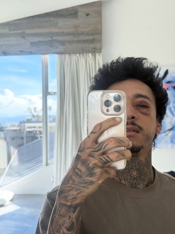 Así quedó el rostro de