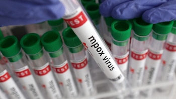 Colombia detecta primer caso de nueva variante de viruela símica y activa vigilancia, sin aumento del riesgo general