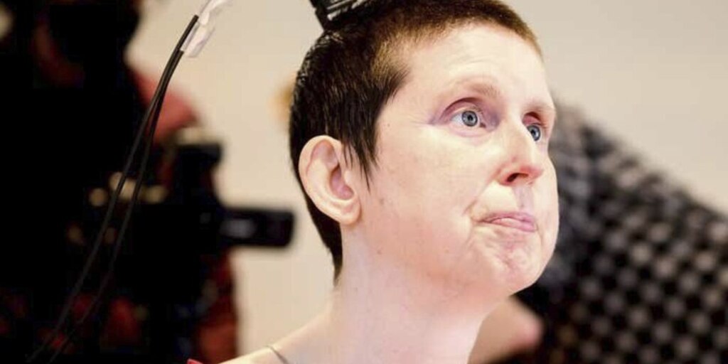 Una mujer volvió a hablar después de 18 años gracias a un implante cerebral con IA - Infobae