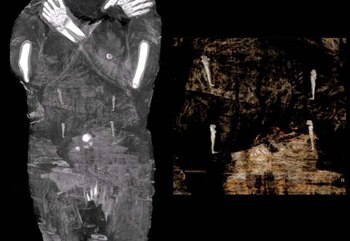 Las imágenes de rayos X