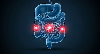 Representación 3D del sistema digestivo humano, con intestinos delgado y grueso en tono azul. Puntos rojos brillantes indican áreas de malestar.