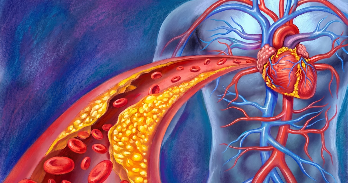 Más allá del colesterol LDL: la proteína apoB surge como el marcador clave para predecir el riesgo cardiovascular