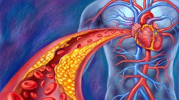 No es solo el colesterol LDL: cuál es la proteína sanguínea que es clave para evaluar el riesgo cardiovascular