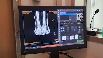Una pantalla de ordenador muestra una tomografía computarizada de las piernas o tobillos de un esqueleto en un fondo oscuro, con texto y controles de software visibles