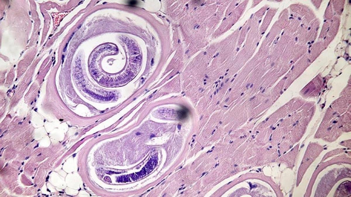 Alertan por la enfermedad triquinosis, producida por un gusano llamado Trichinella