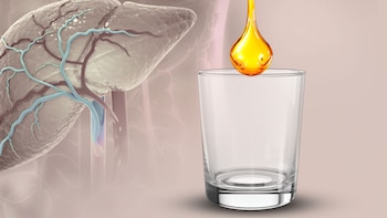 Hígado graso: beber este remedio