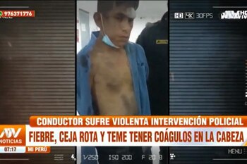 Erick José Alquiman Vargas permaneció