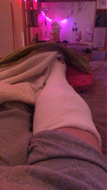 Zurik requiere de una cirugía