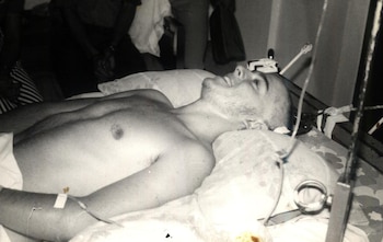 Bernardo quedó cuadripléjico a los