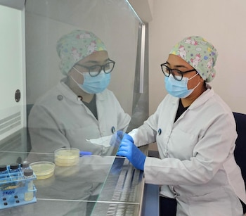 El parásito Trypanosoma cruzi se transmite de madre a hijo durante el embarazo, persistiendo incluso donde ha disminuido el vector doméstico. (Foto cortesía CENSALUD)