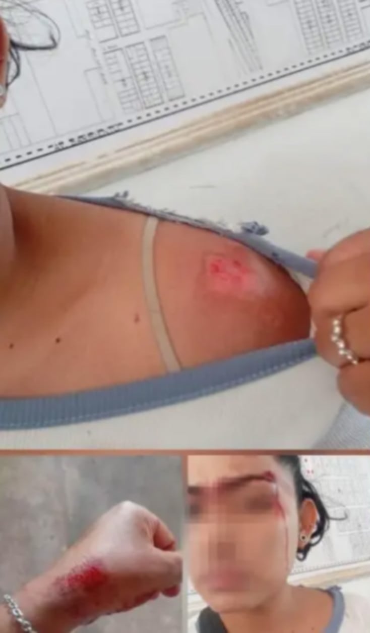 La víctima tenía una prohibición de acercamiento contra el acusado y contaba con un botón de pánico de la aplicación Alerta Mujer. (Diario Chaco)