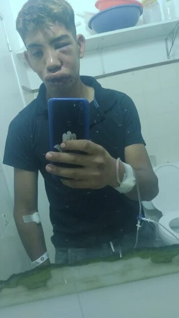 Por los golpes que recibió,