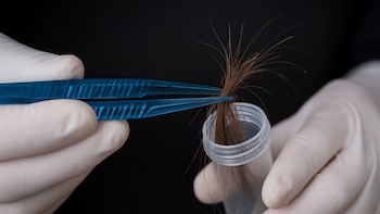 Las bacterias del cuero cabelludo,