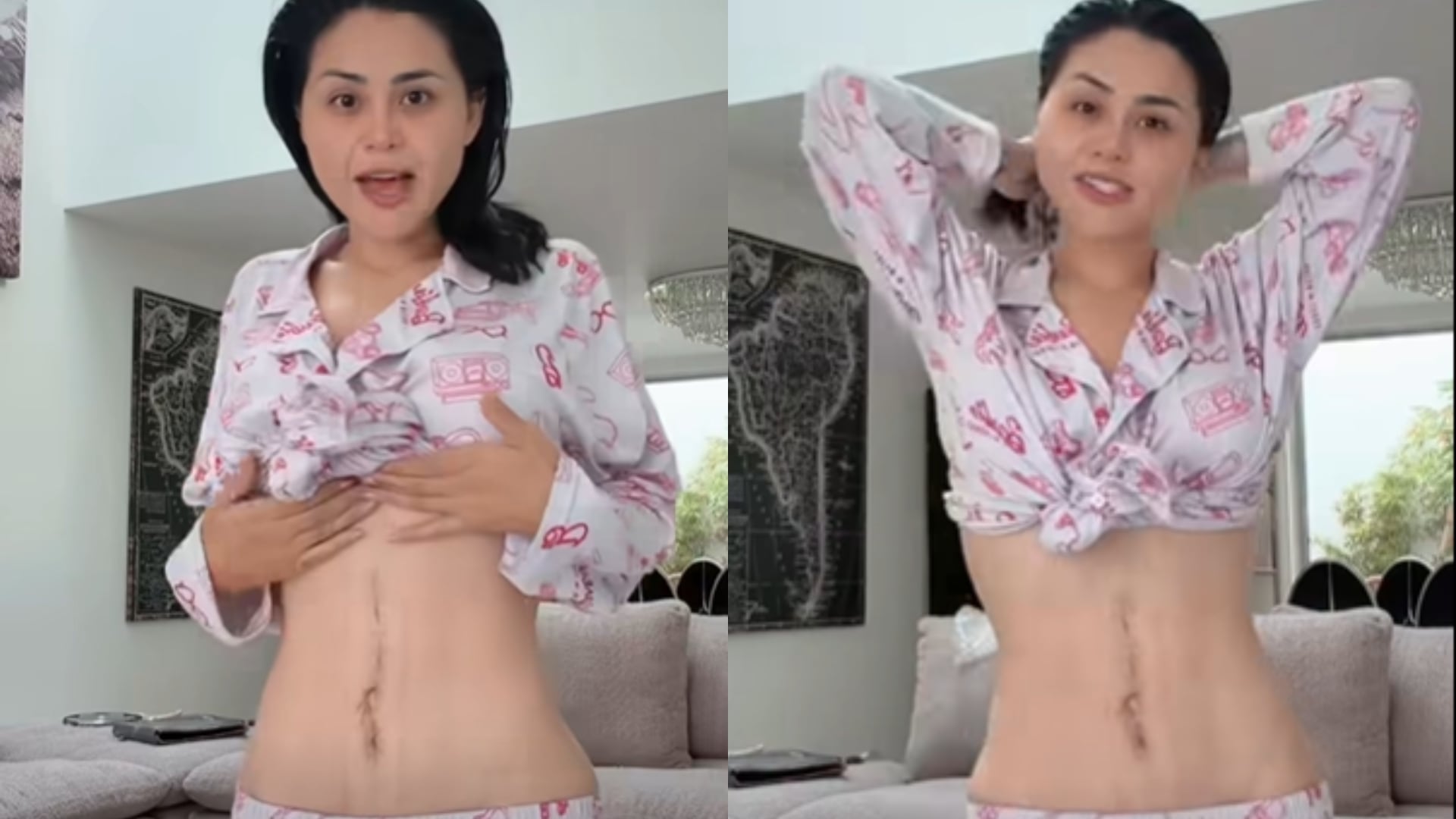 Gomita sorprende al mostrar en video las cicatrices que le quedaron tras cirugía que casi le cuesta la vida
(RS)