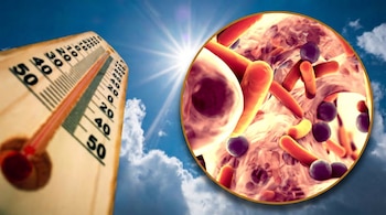 Imagen de un termómetro marcando más de 40 grados Celsius bajo el sol. A la derecha, un círculo muestra una vista ampliada de microbios de formas diversas.
