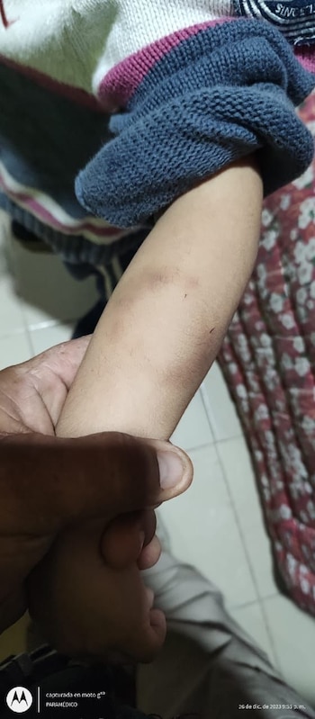 Los menores tenían marcas visibles