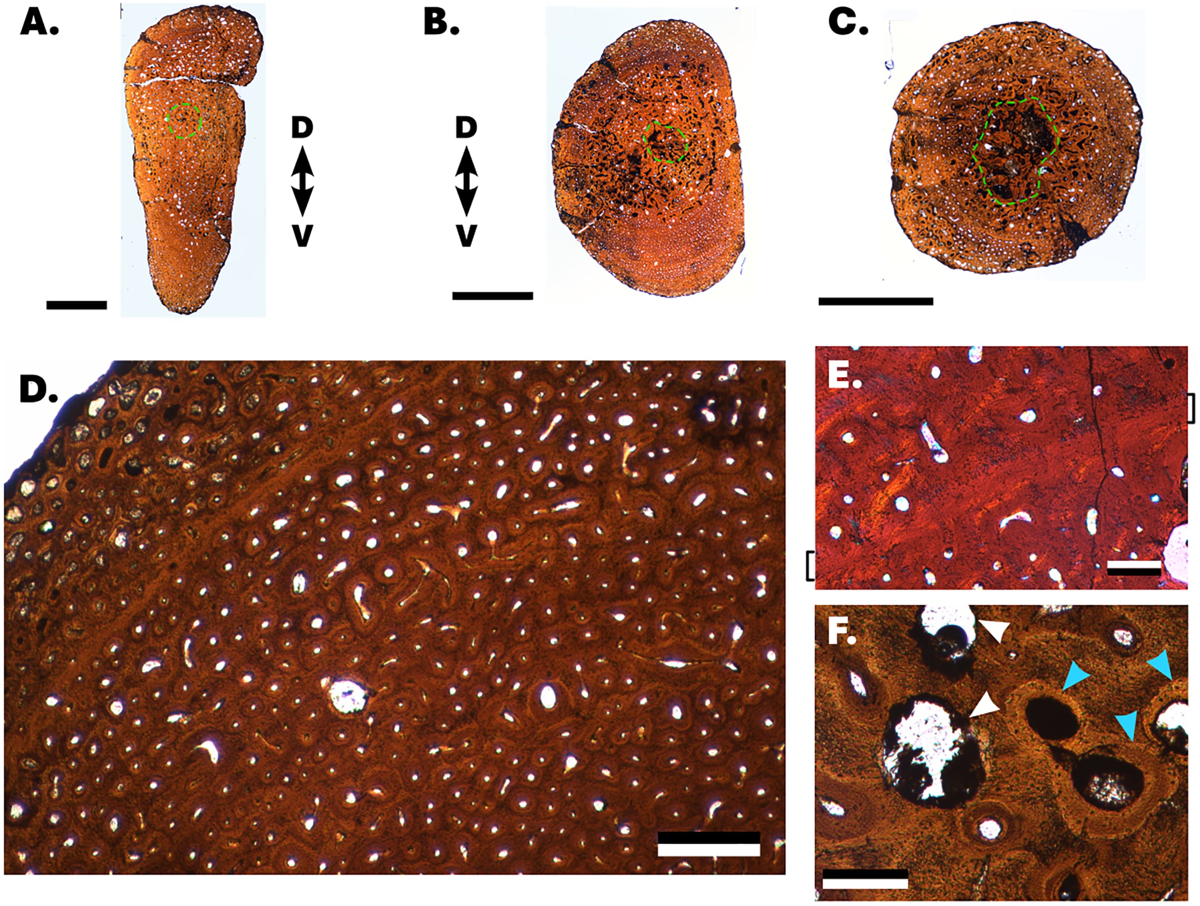 La microanatomía de fósiles de 150 millones de años permitió identificar estructuras comparables a las de cetáceos actuales (Gentileza, estudio Microestructura de las costillas en ictiosaurios tuniformes y ballenas dentadas, publicado en PeerJ)