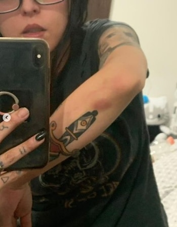 La joven mostró algunos hematomas