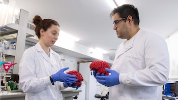 El autismo y la esquizofrenia podrían activarse con un “interruptor molecular” que es esencial para el desarrollo del cerebro, según un estudio