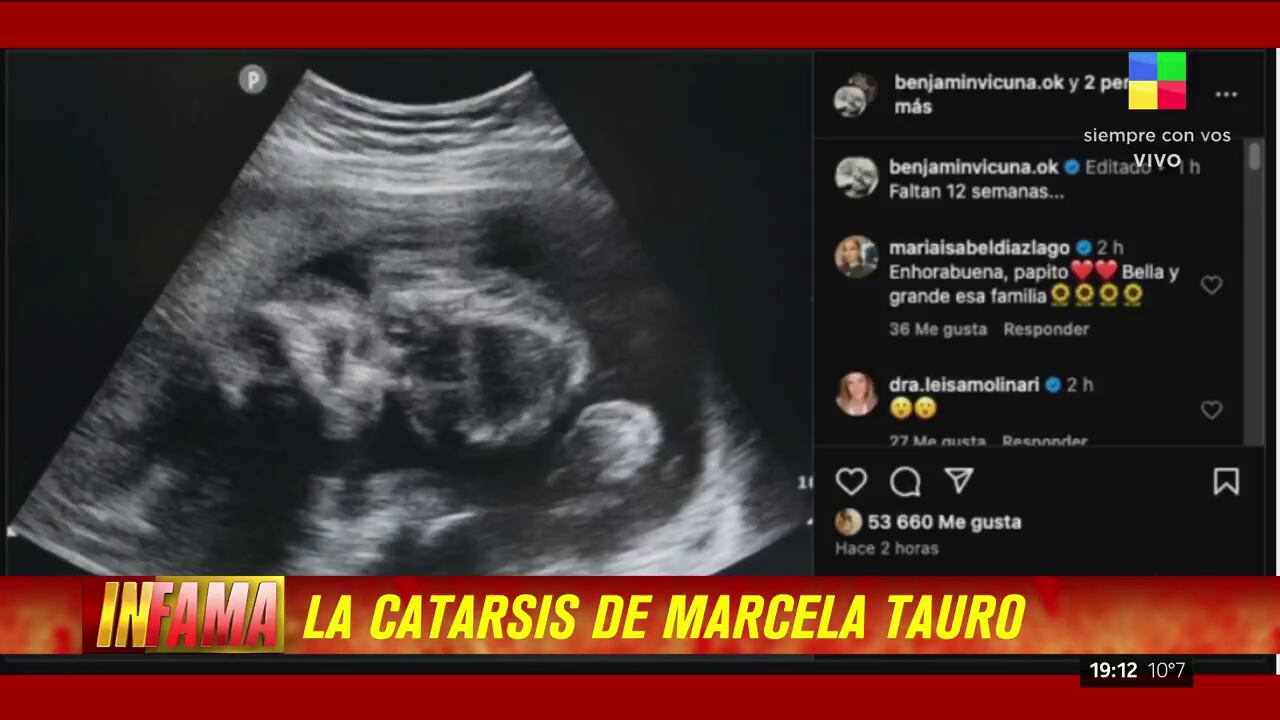 La ecografía que compartió Benjamín Vicuña para promocionar su próxima película y el enojo de Marcela Tauro (Infama, LAM)