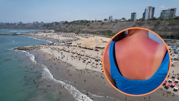 Radiación ultravioleta puede causar efectos