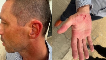 El traumatólogo mostró las lesiones