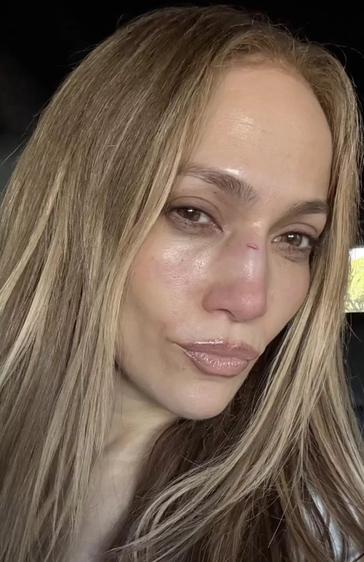 Jennifer Lopez resultó herida durante un ensayo para los AMAs 2025 (captura: Instagram/J.Lo)