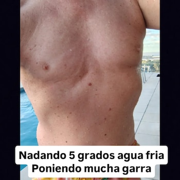 Leandro Rud utiliza su historia para motivar a pacientes oncológicos y valora la influencia positiva de la actividad física en su mejoría