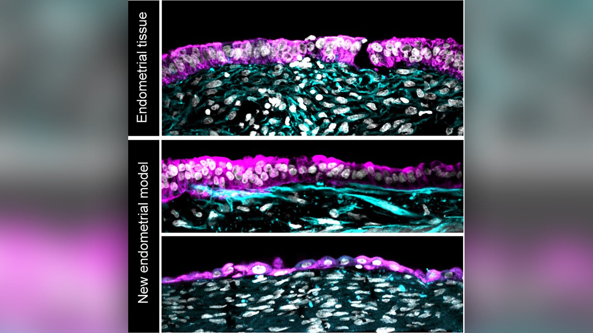 Los experimentos con embriones humanos de FIV muestran adhesión, invasión en el endometrio artificial y secreción de proteínas asociadas al embarazo como la hCG./ Max Polanek Stanford University