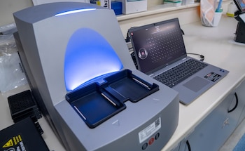 Tecnología para analizar biomarcadores de Alzheimer, Esclerosis Múltiple, ELA y otras enfermedades (gentileza Fleni)