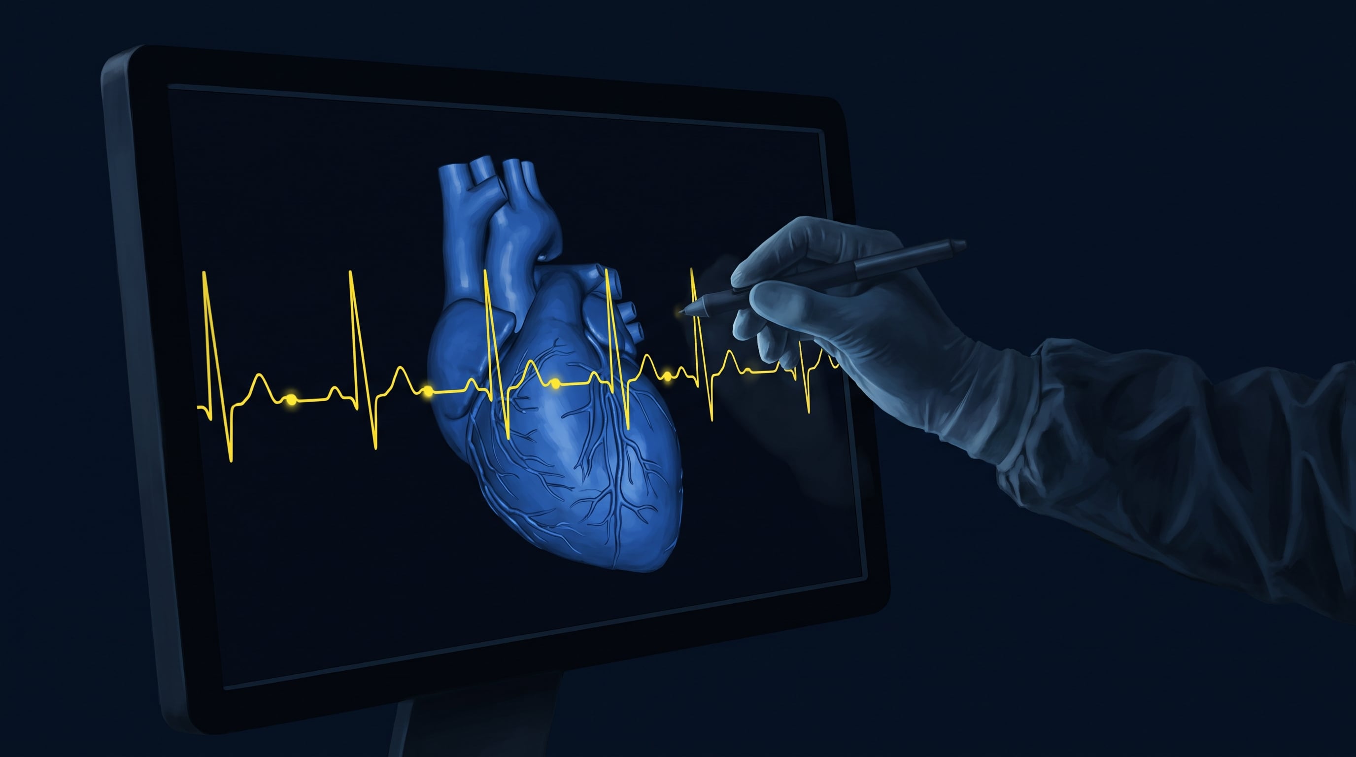 Un electrocardiograma permite detectar la prolongación del intervalo QT, una señal característica de la enfermedad (Imagen Ilustrativa Infobae)