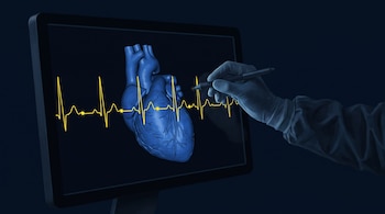 Pantalla con un corazón azul en tres dimensiones, una línea amarilla de electrocardiograma y una mano con guante que sostiene un lápiz digital.