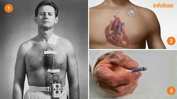 Tres imágenes: un hombre con un marcapasos externo, una ilustración de un marcapasos interno y una mano sosteniendo un micro marcapasos