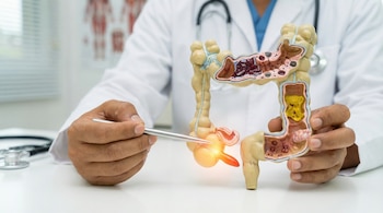 Un médico con bata blanca apunta con una pinza metálica a un modelo anatómico del colon y apéndice humano, que está iluminado. Se ve un estetoscopio.