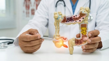 Cuáles son las señales que pueden indicar una apendicitis y cuándo acudir a emergencias