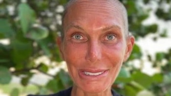 Yola Berrocal, su impactante cambio de look con el pelo rapado al cero: "Me siento imparable"