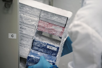 La temperatura que requiere la