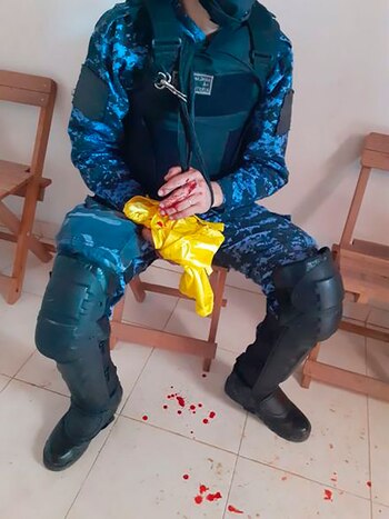 Uno de los policías heridos