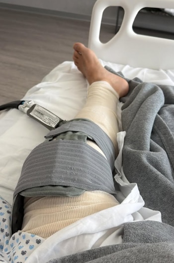 La pierna izquierda del actor permaneció inmovilizada con vendaje compresivo y un sistema de crioterapia para disminuir el dolor.