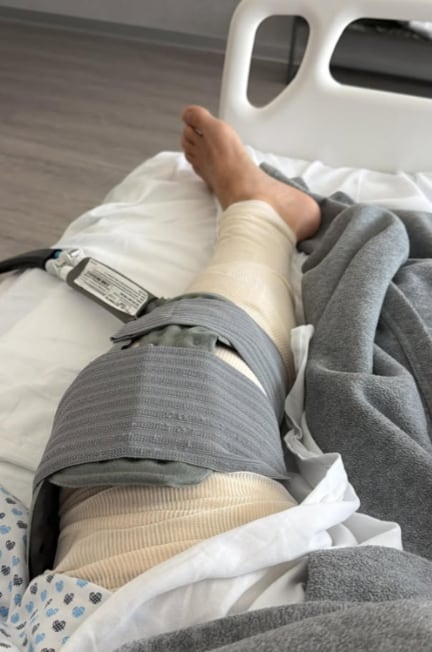 La pierna izquierda del actor permaneció inmovilizada con vendaje compresivo y un sistema de crioterapia para disminuir el dolor tras la operación. (IG: ponchohd)