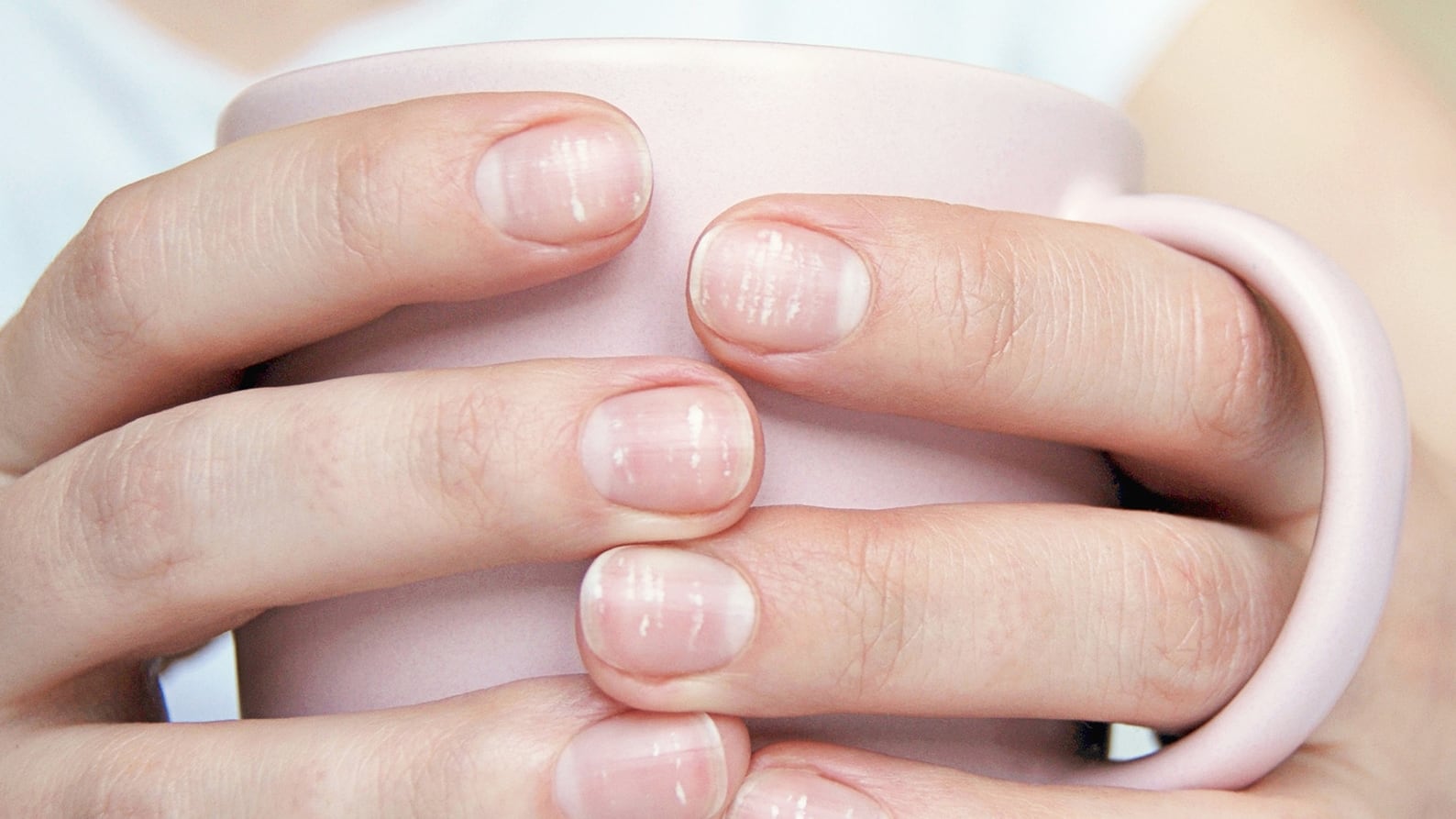 Las manchas blancas en las uñas, también conocidas como leuconiquia, pueden ser un indicador de la salud general del cuerpo (Freepik)